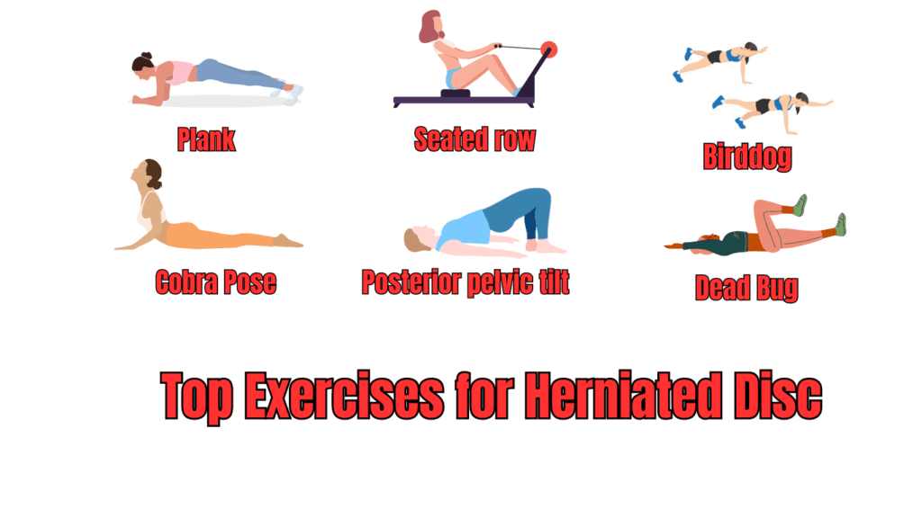 Top 6 exercises for Herniated Disc