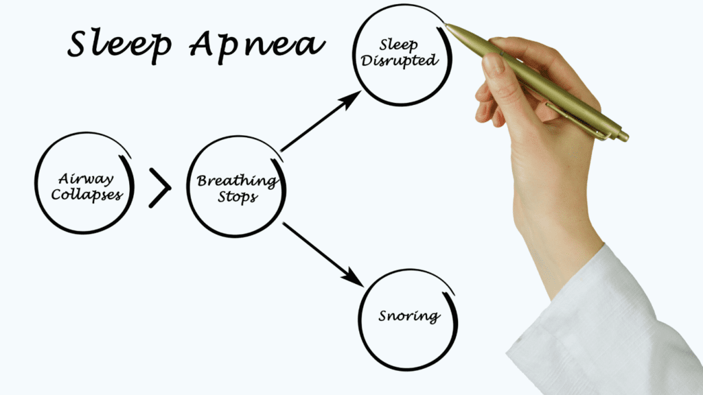 What is sleep apnea explained in a diagram 