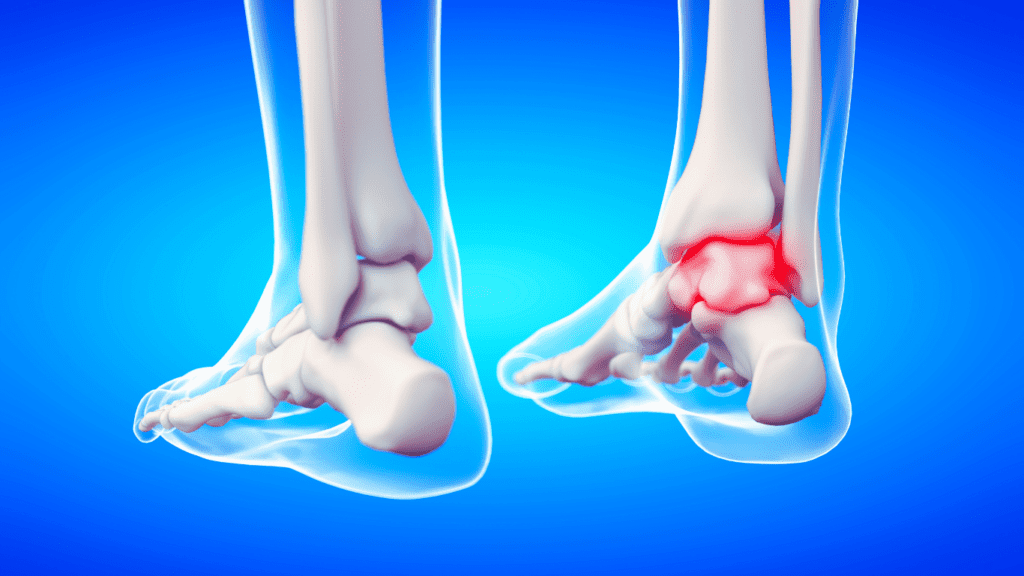 Anatomy Of The Ankle Photo 